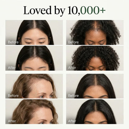 EZMIRALD™ Korean Scalp Revival Bar