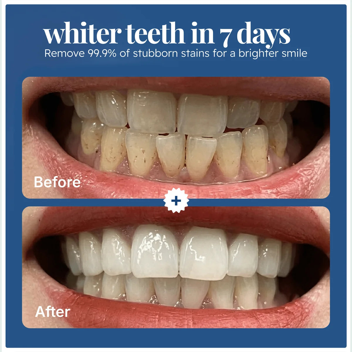 EZMIRALD® Triple Action Teeth Whitening Powder